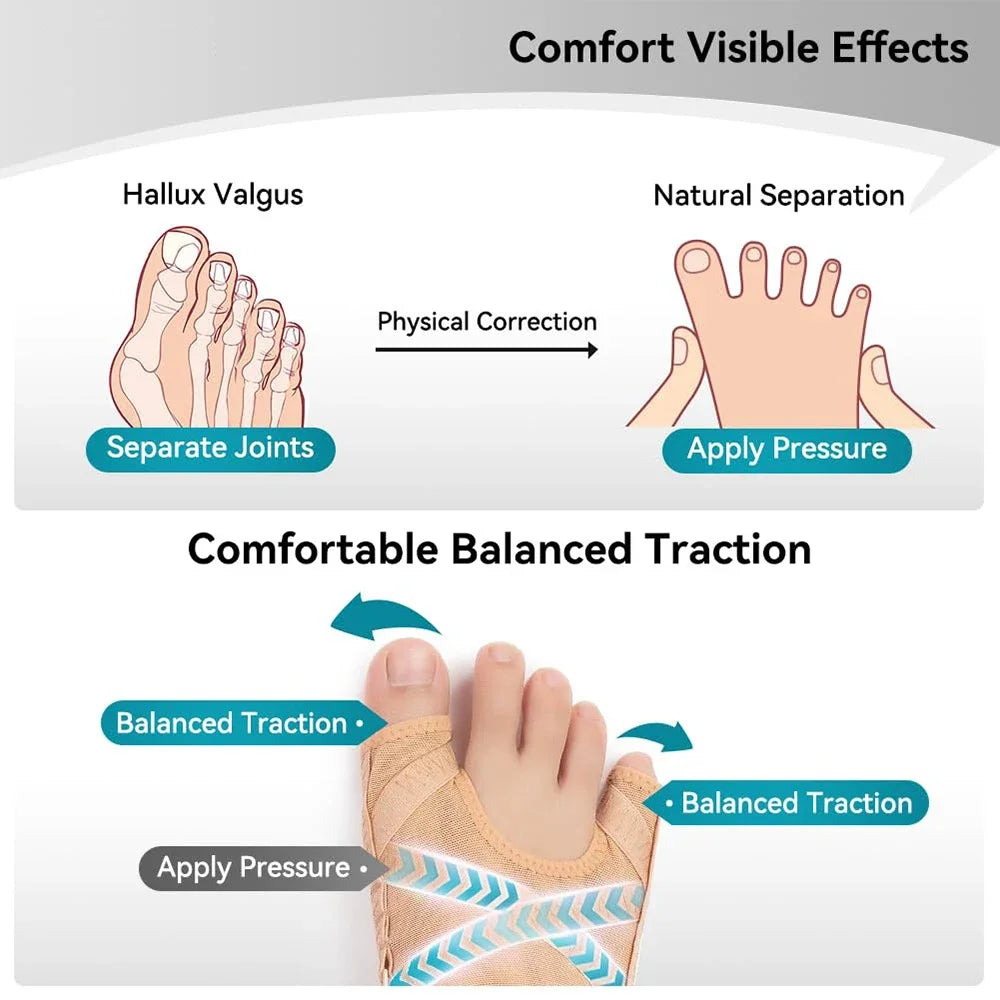 Adjustable Hallux Valgus Bunion Corrector Toe Separator Orthotics Feet Bone Adjuster Thumb Straightener Pedicure Foot Care Tools