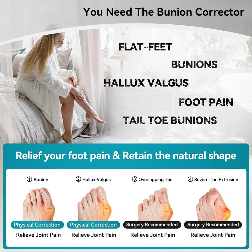 Adjustable Hallux Valgus Bunion Corrector Toe Separator Orthotics Feet Bone Adjuster Thumb Straightener Pedicure Foot Care Tools