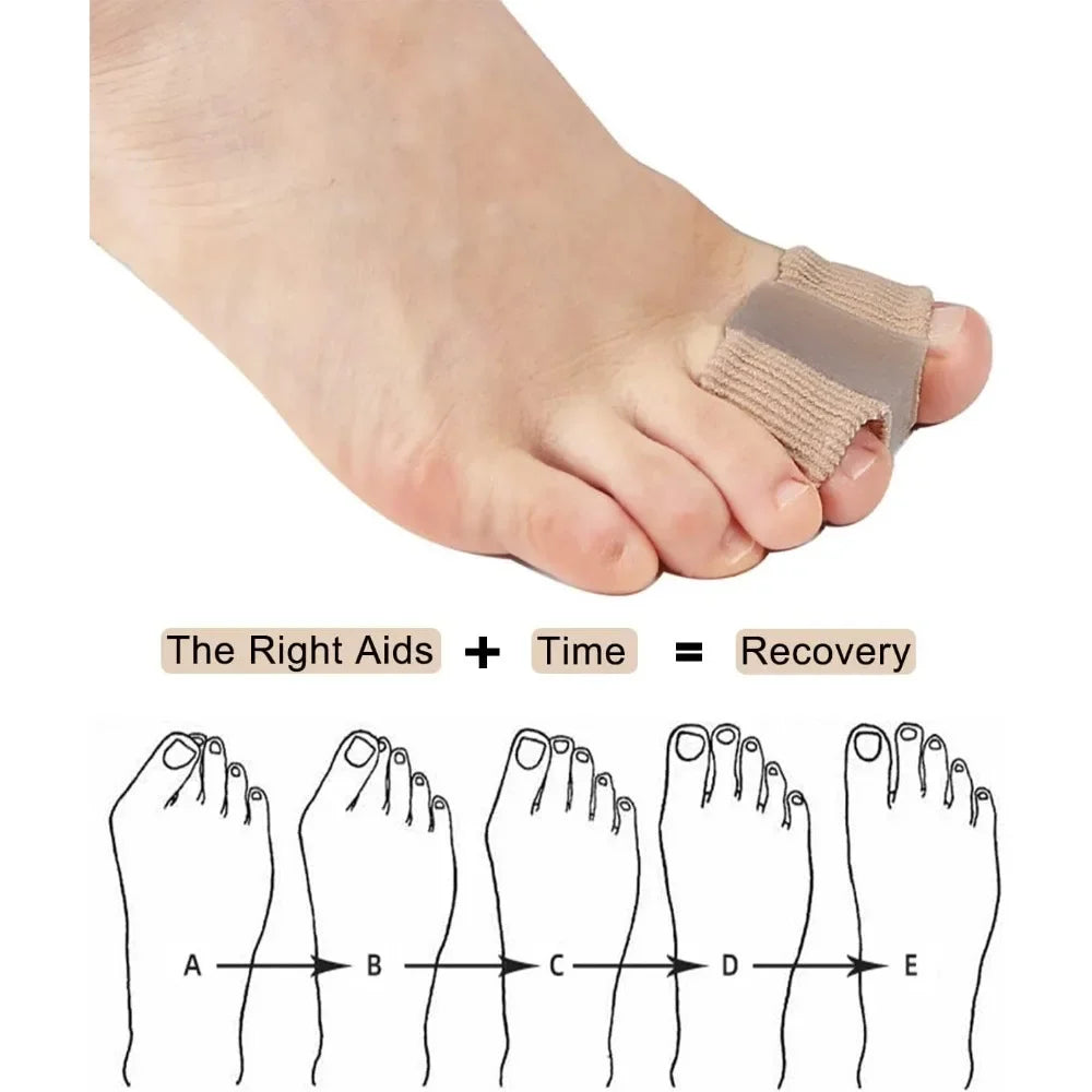 Adjustable Hallux Valgus Bunion Corrector Toe Separator Orthotics Feet Bone Adjuster Thumb Straightener Pedicure Foot Care Tools